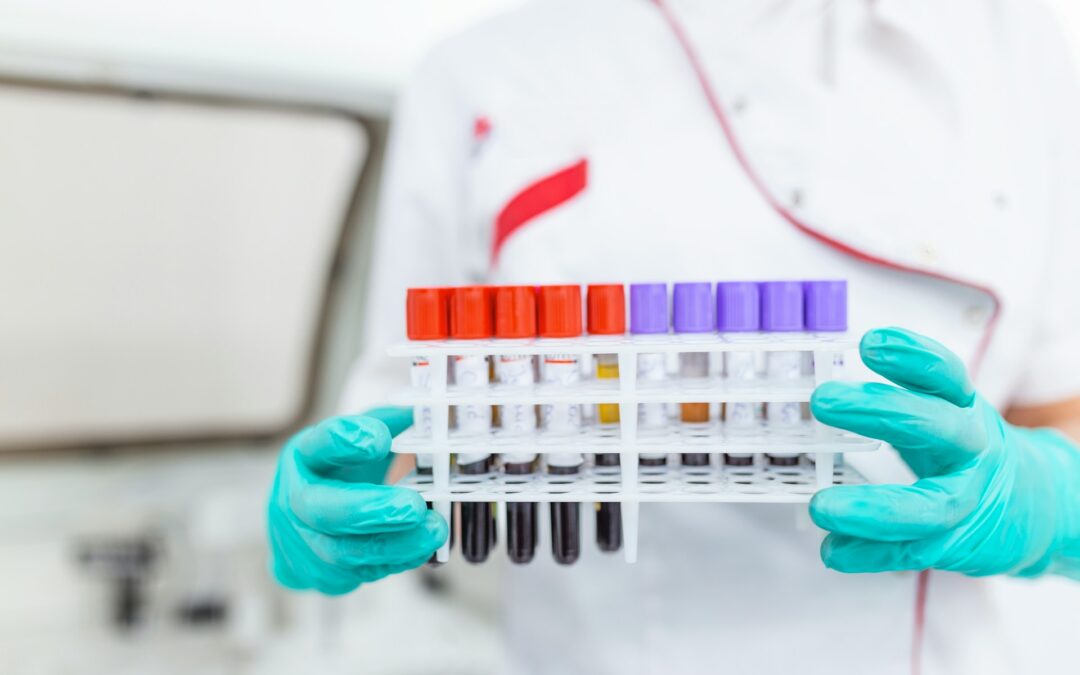 specimen procedures in Roswell, GA