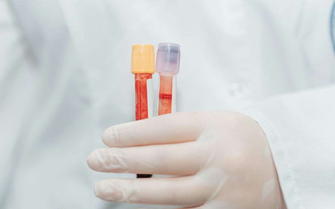 How to Become a Phlebotomist in Georgia (Atlanta Guide): Training, Timeline, and Certification Steps